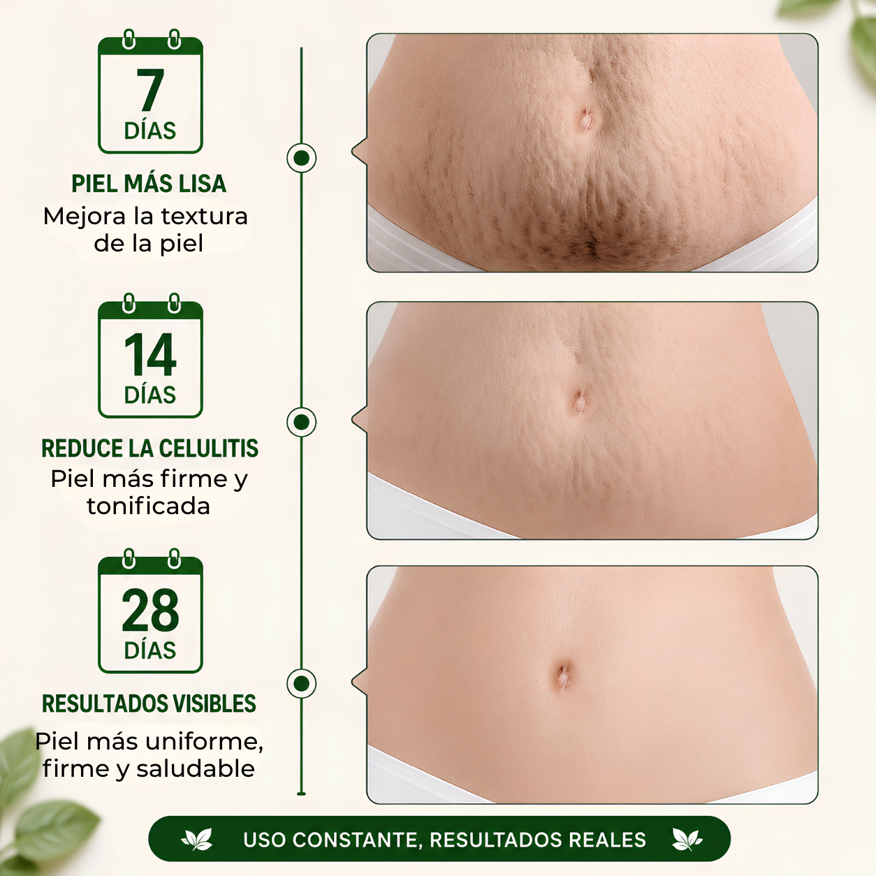 Crema Control Celulítico – Piel Más Firme, Suave y Visiblemente Uniforme