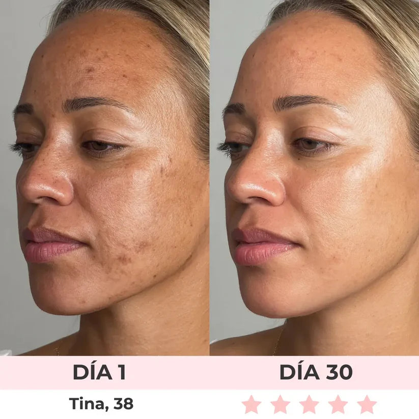 CLARA TIERRA 7-EN-1 Escultor Facial LED