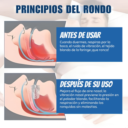 Protector bucal antironquidos: Duerme en silencio y despierta renovado