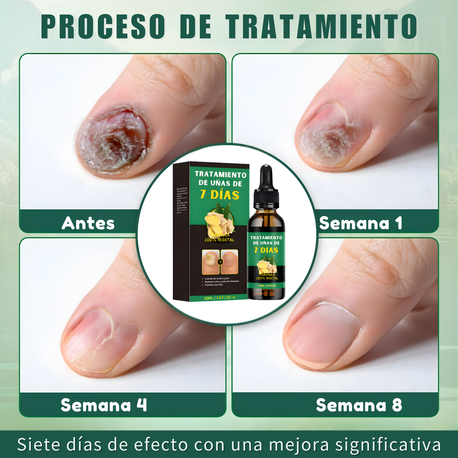Tratamiento para hongos en las uñas: uñas más sanas, limpias y fuertes desde la raíz.