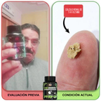 Stone Dissolver+ – Suplemento Natural para Eliminar Cálculos Renales y Proteger la Salud Urinaria