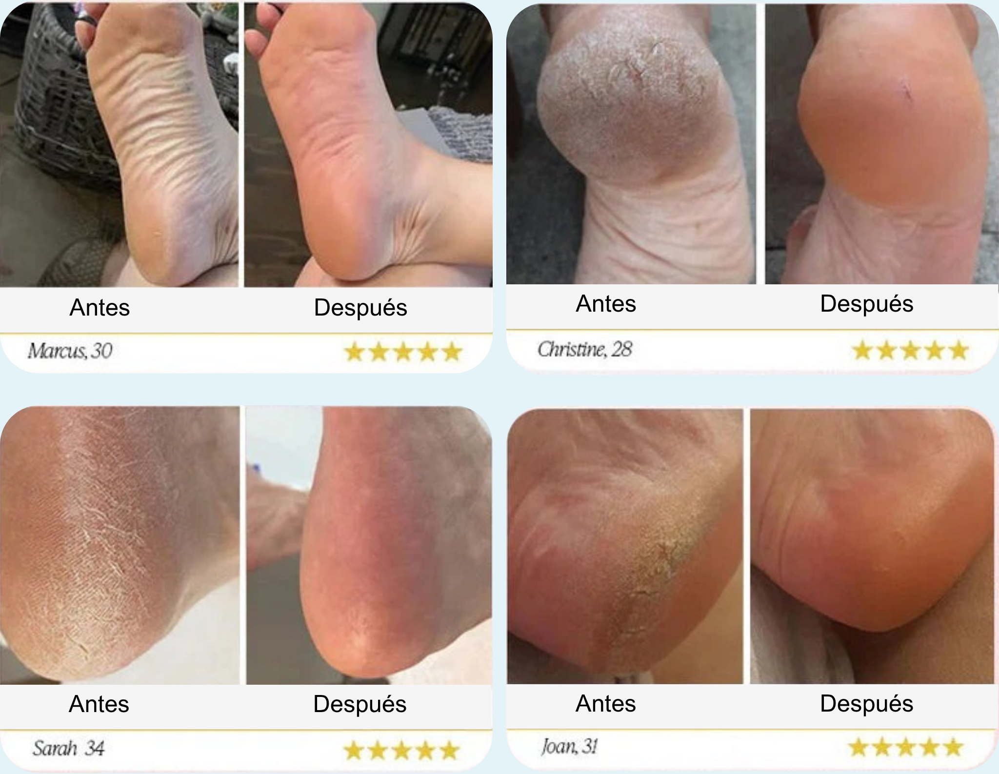 Lima Eléctrica para Pies + 60 Discos de Repuesto GRATIS – Elimina Callos y Durezas al Instante