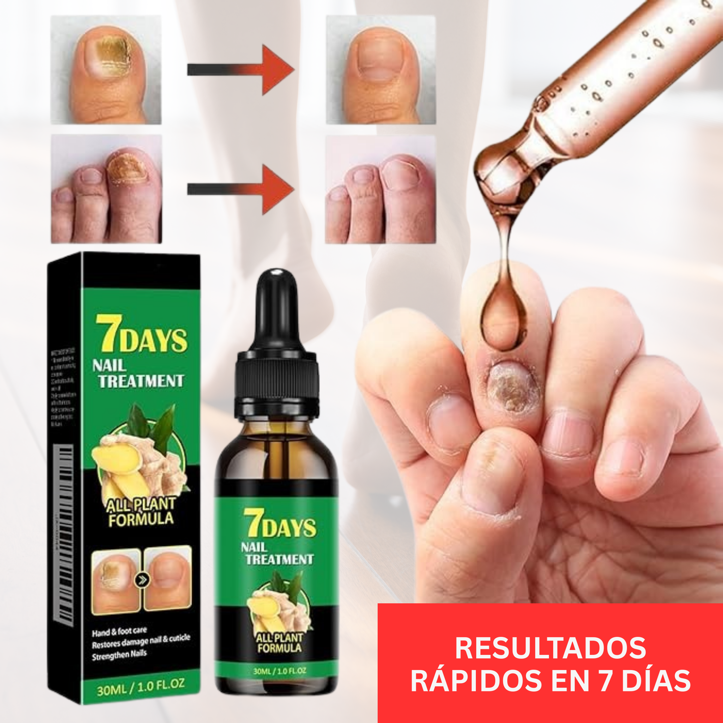 Uñas Libres de Hongos en 7 Días – Tratamiento Natural y Efectivo