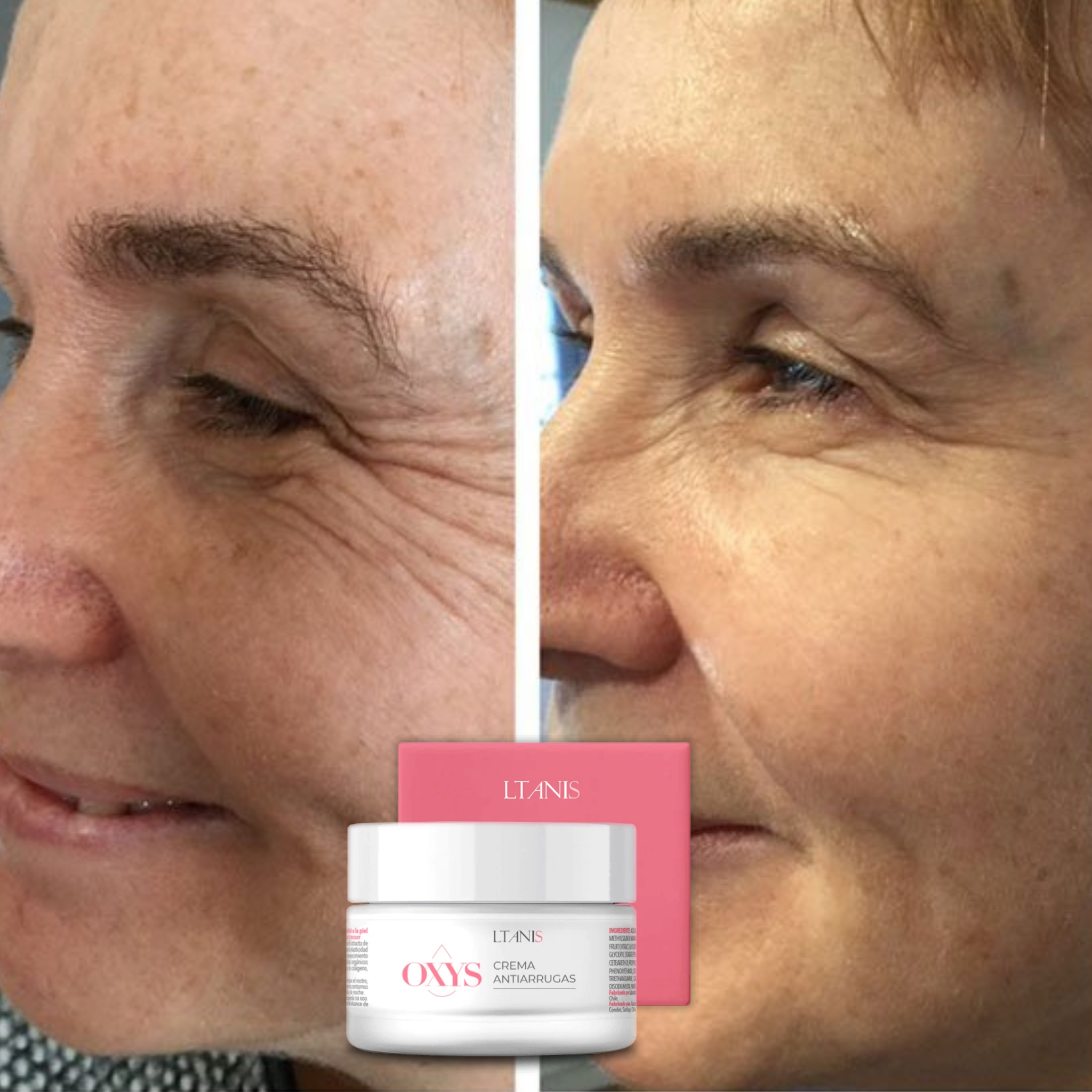 OXYS® Crema Antiarrugas con Efecto Lifting Inmediato – Día y Noche