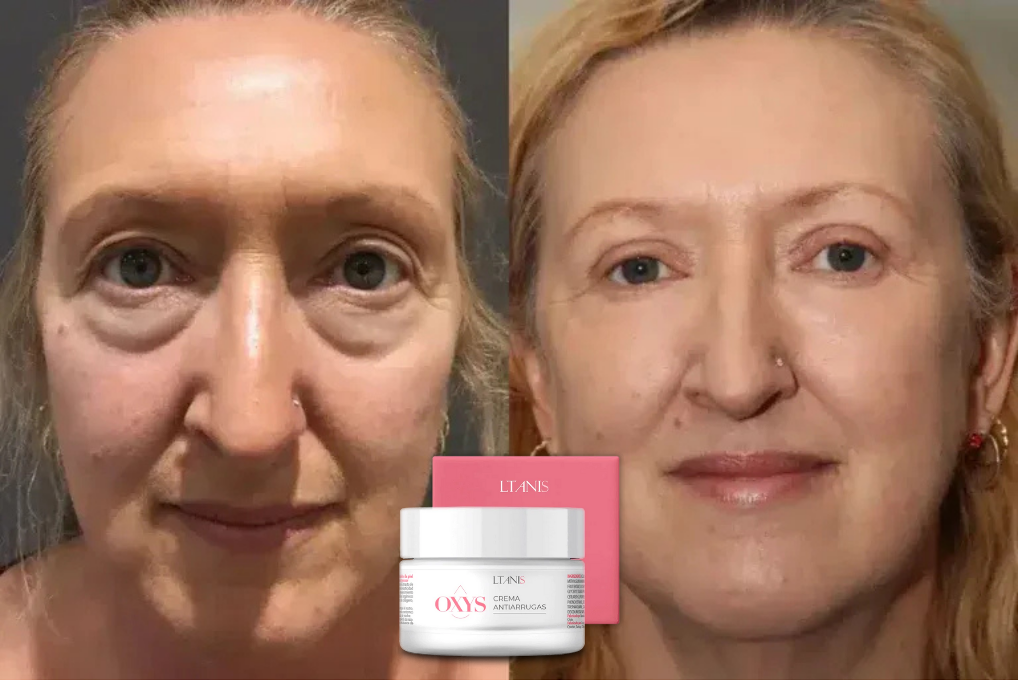 OXYS® Crema Antiarrugas con Efecto Lifting Inmediato – Día y Noche