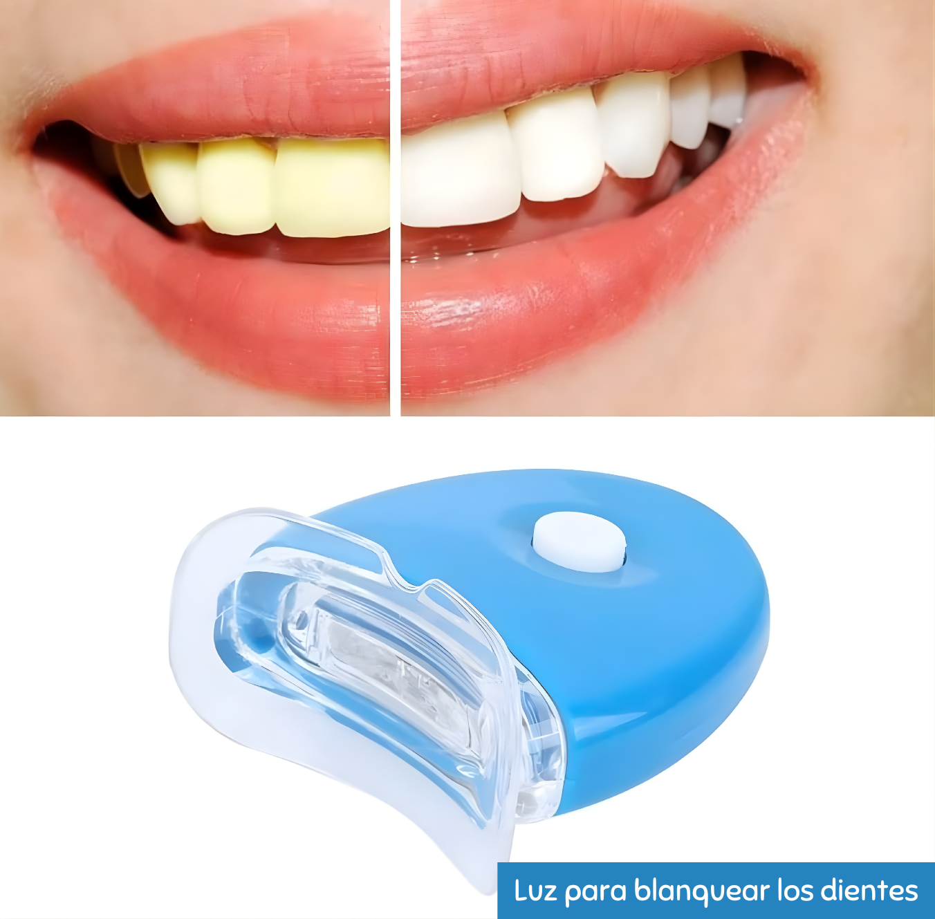 Kit de blanqueamiento dental con luz LED UV: sonrisas más brillantes y saludables en cuestión de días