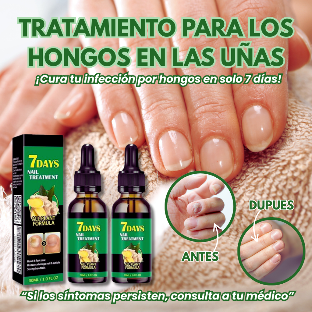 Uñas Libres de Hongos en 7 Días – Tratamiento Natural y Efectivo