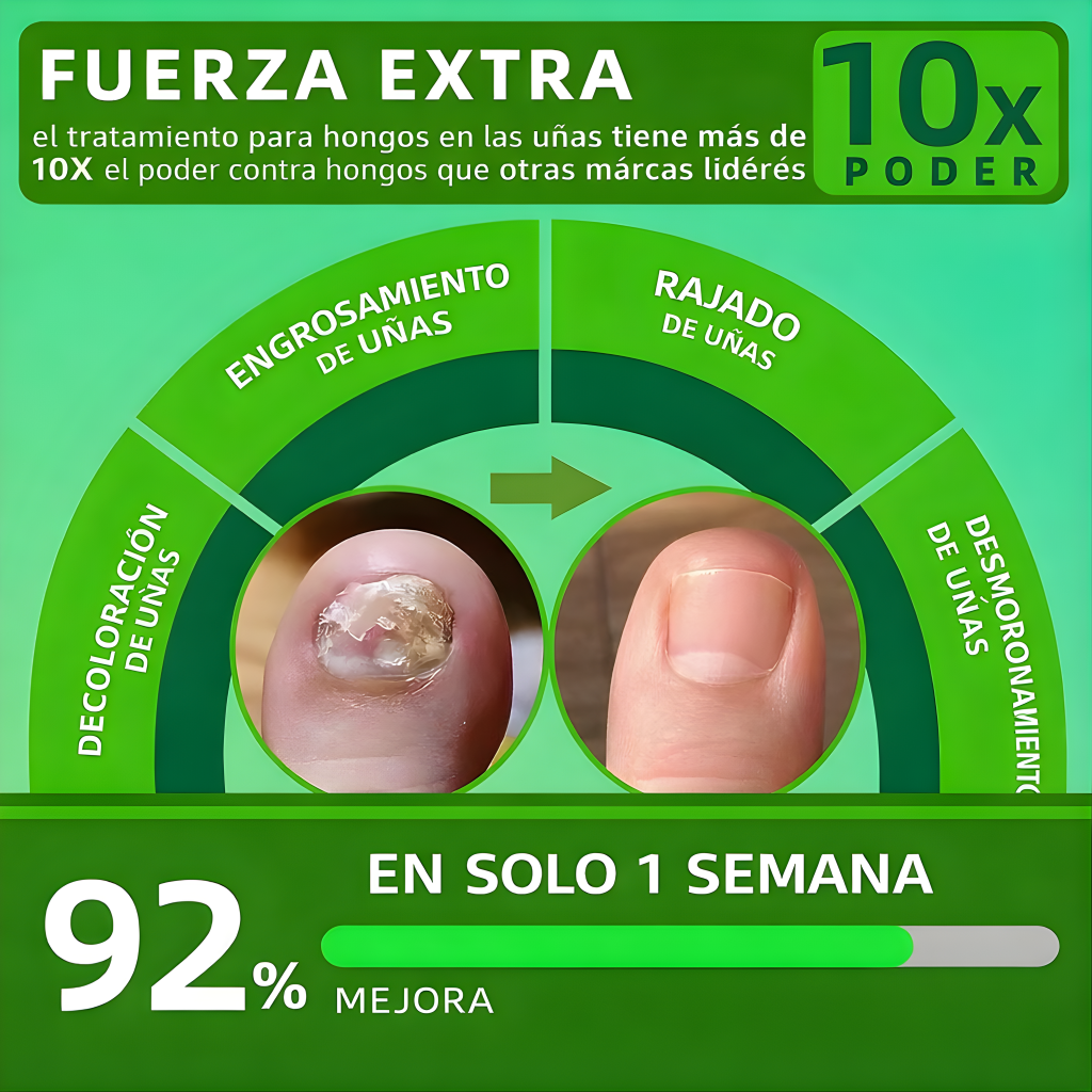 Tratamiento para hongos en las uñas: uñas más sanas, limpias y fuertes desde la raíz.