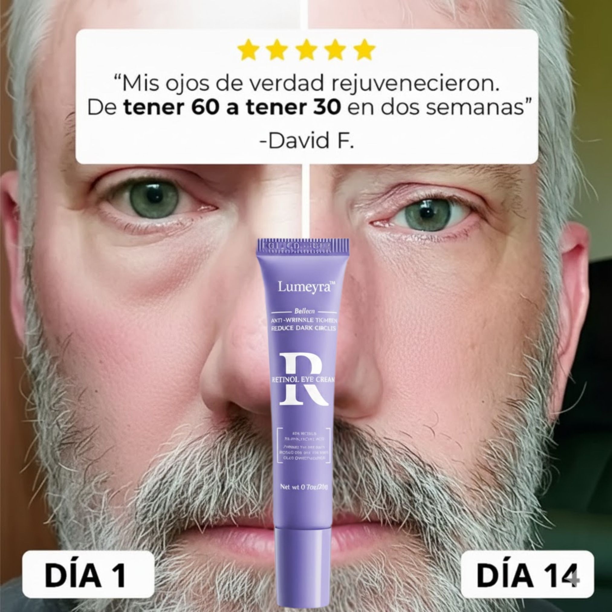 Lumeyra™ - Reparador de bolsas y ojeras