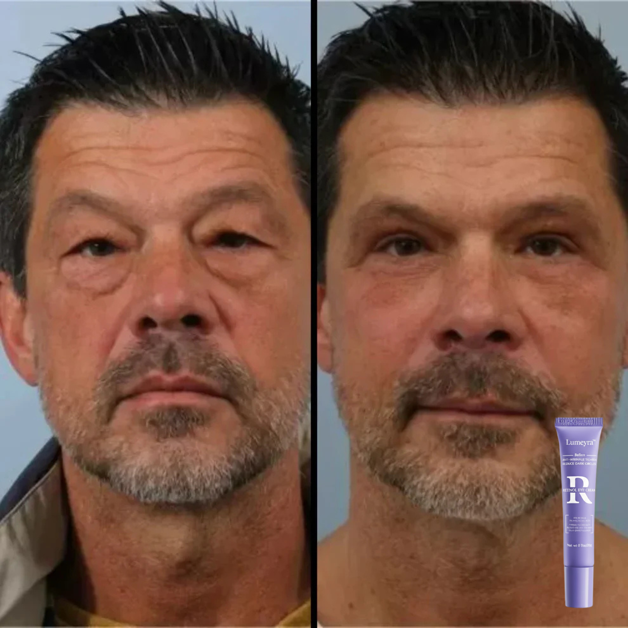 Lumeyra™ - Reparador de bolsas y ojeras