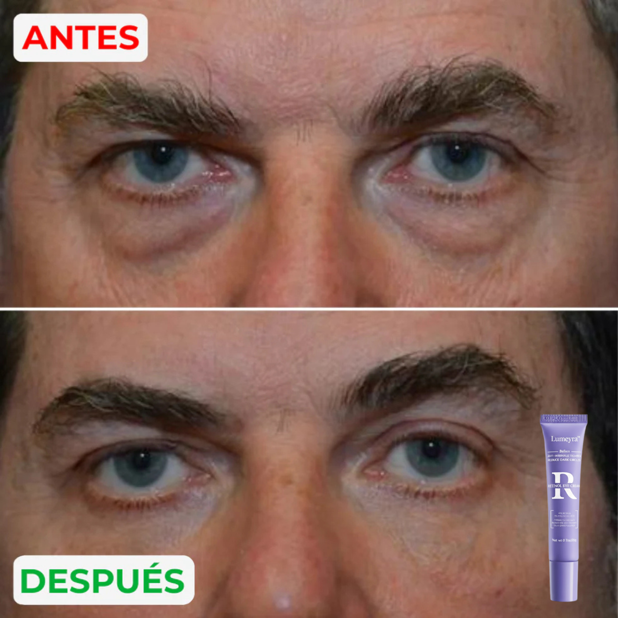 Lumeyra™ - Reparador de bolsas y ojeras