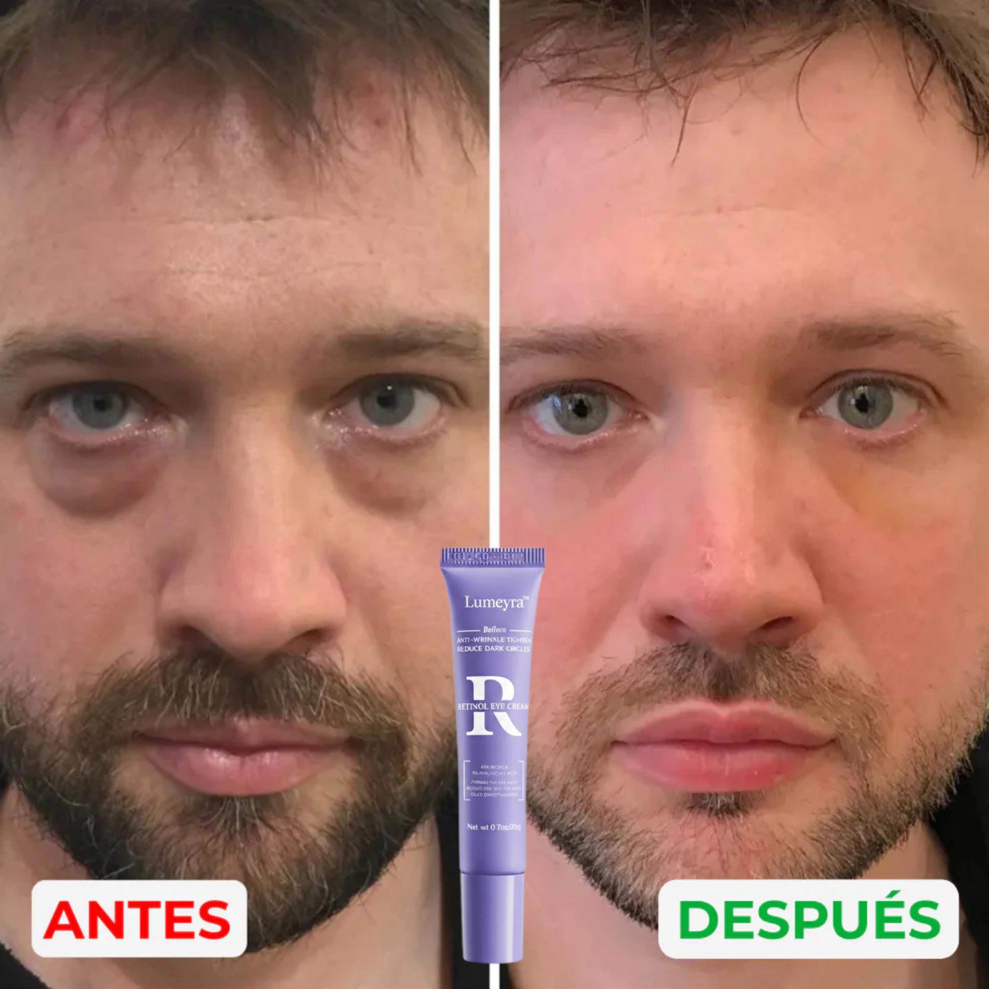 Lumeyra™ - Reparador de bolsas y ojeras