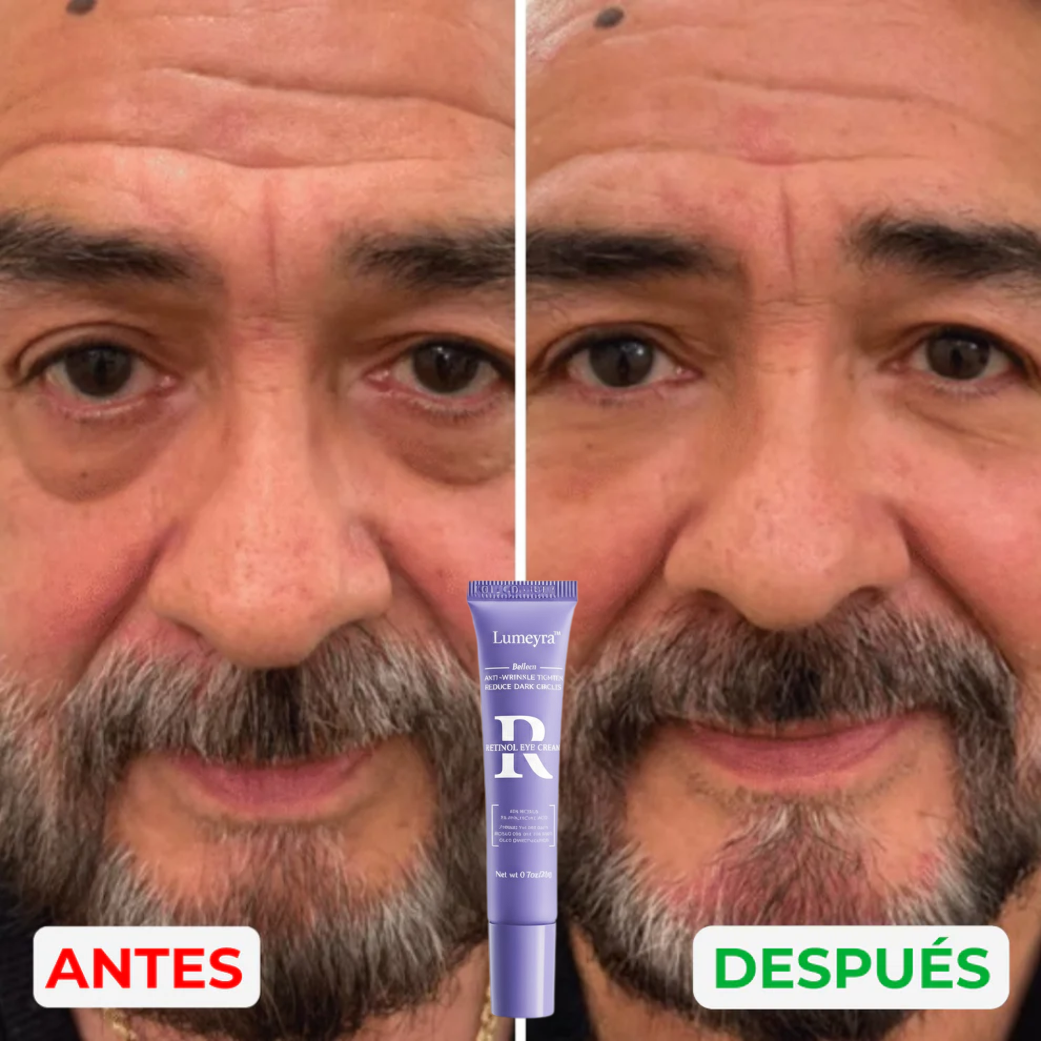 Lumeyra™ - Reparador de bolsas y ojeras