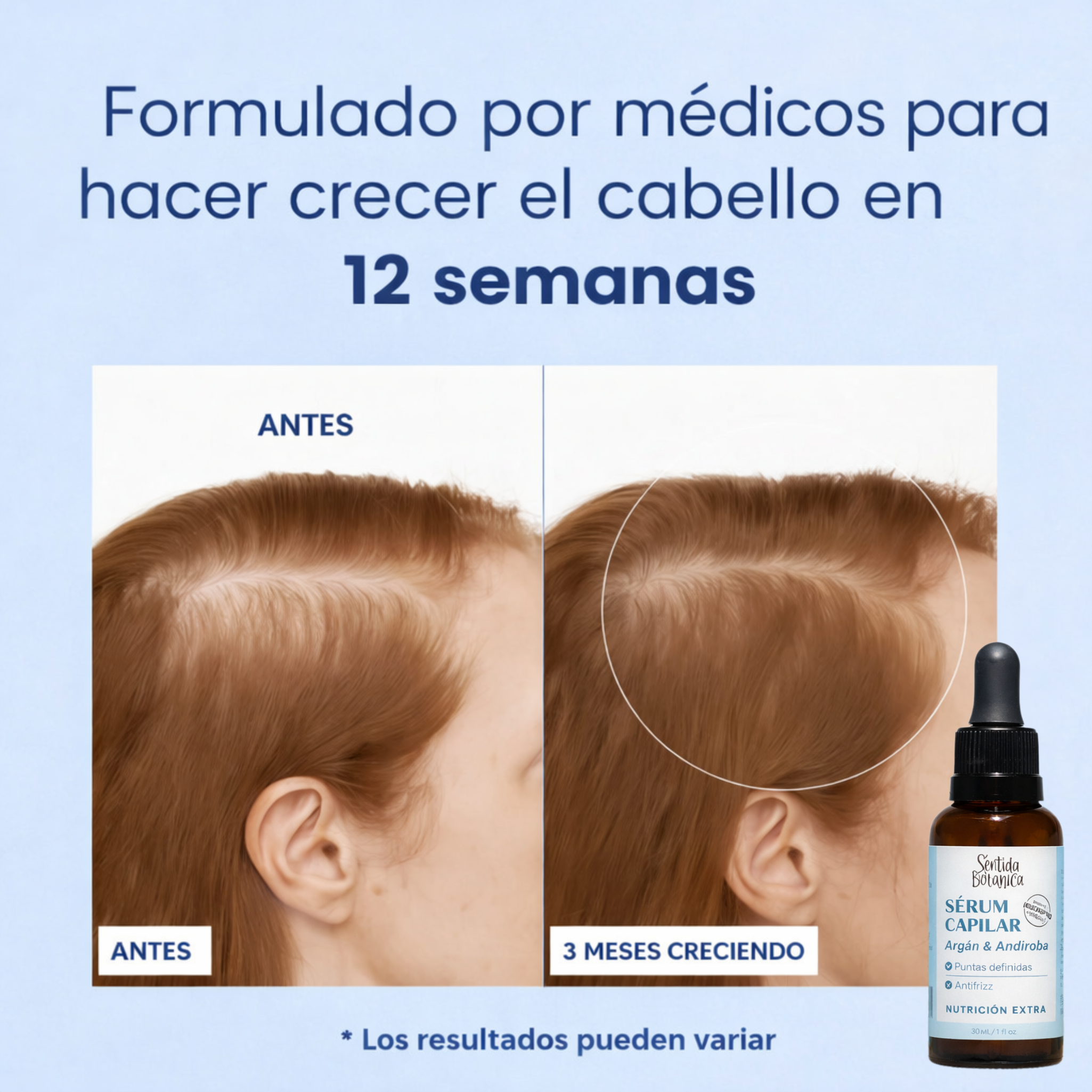 Sentida Botánica Sérum Capilar - De la caída… a un pelo más fuerte.