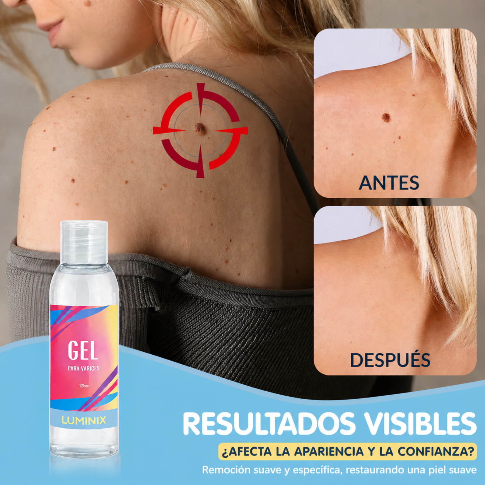 Luminix Gel Reparador 3 en 1 — Elimina Verrugas, Callos y Durezas Rápido