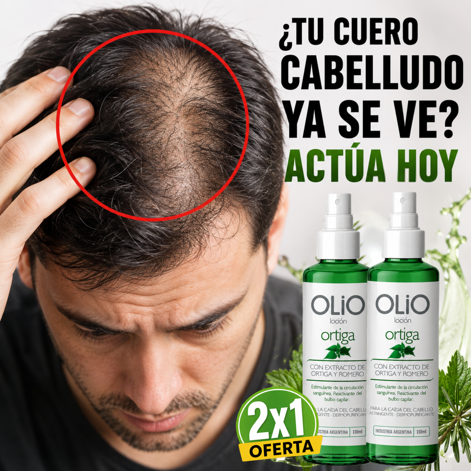 Loción Anticaída OLIO – Fórmula con Ortiga y Romero Oferta limitada 2x1!
