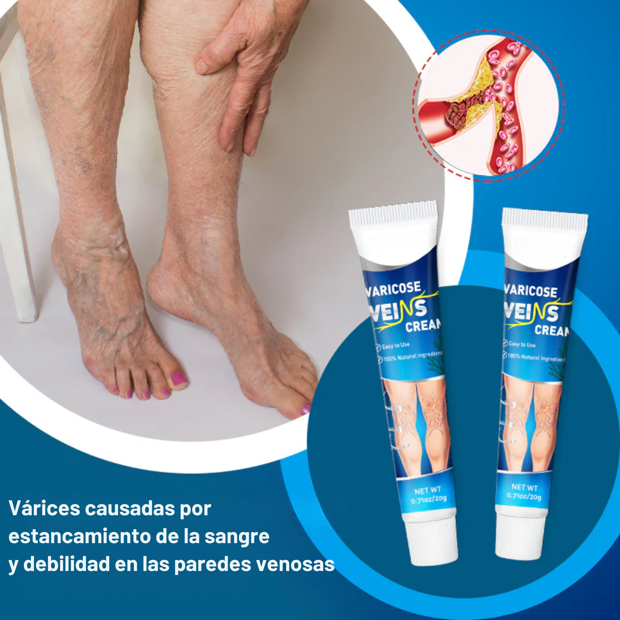 Crema para várices - Alivio inmediato, piernas más livianas y circulación mejorada.