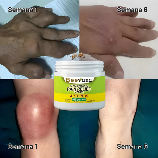 Crema de alivio rápido ultrafuerte: alivio para articulaciones y músculos