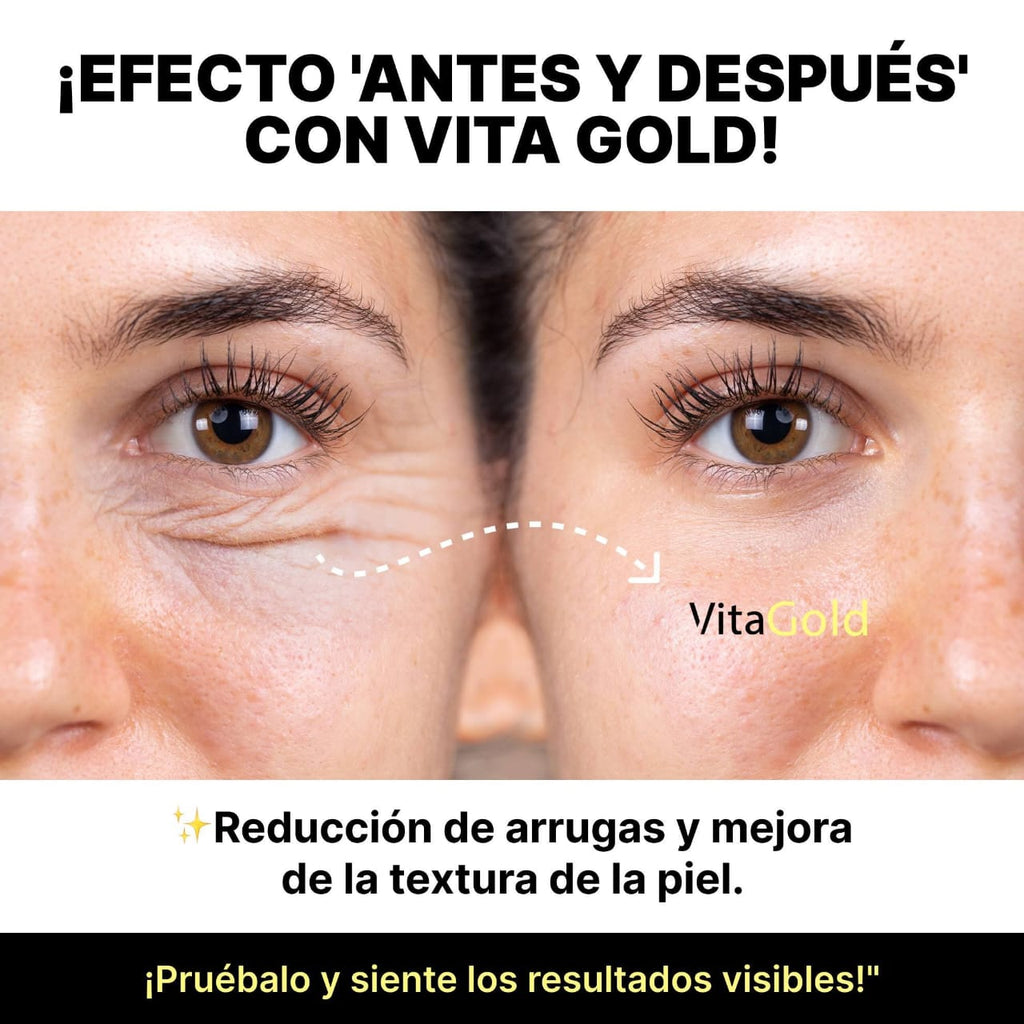 Vitagold - 20 AÑOS MENOS EN 5 MINUTOS