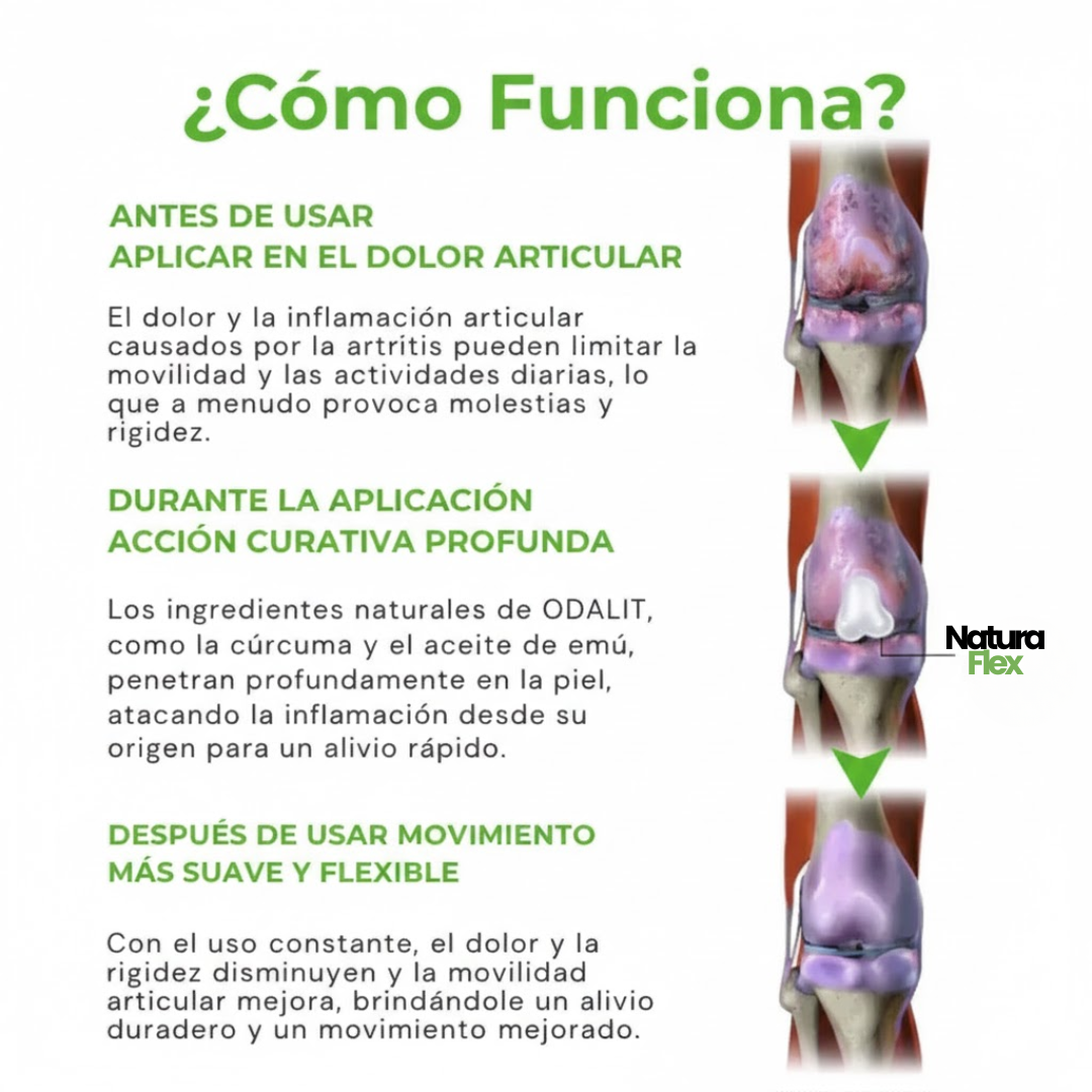 NaturaFlex - Alivio Real, Movimiento Renovado