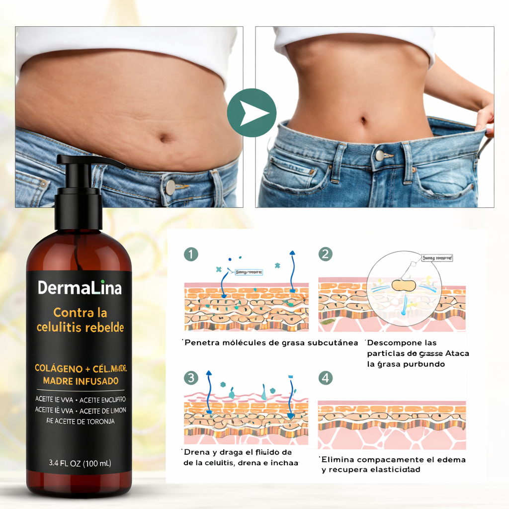 DermaLina — Contra la celulitis rebelde