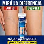 CLARATIERRA® CREMA PARA VÁRICES - Más frescura, ligereza y confort para tus piernas