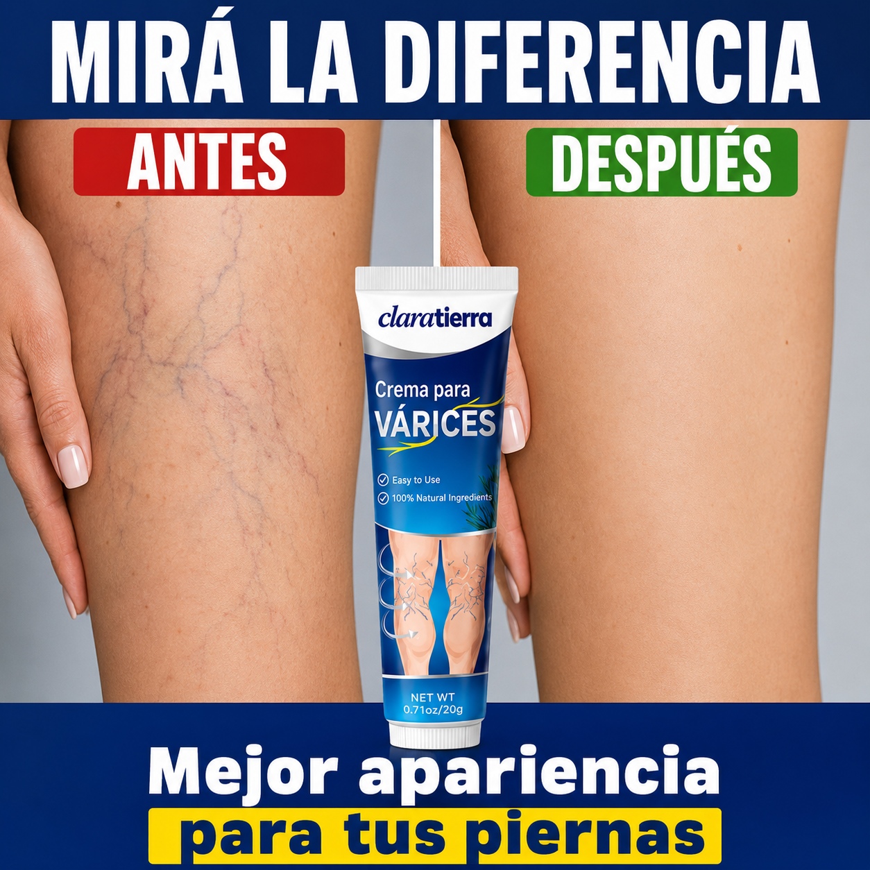CLARATIERRA® CREMA PARA VÁRICES - Más frescura, ligereza y confort para tus piernas