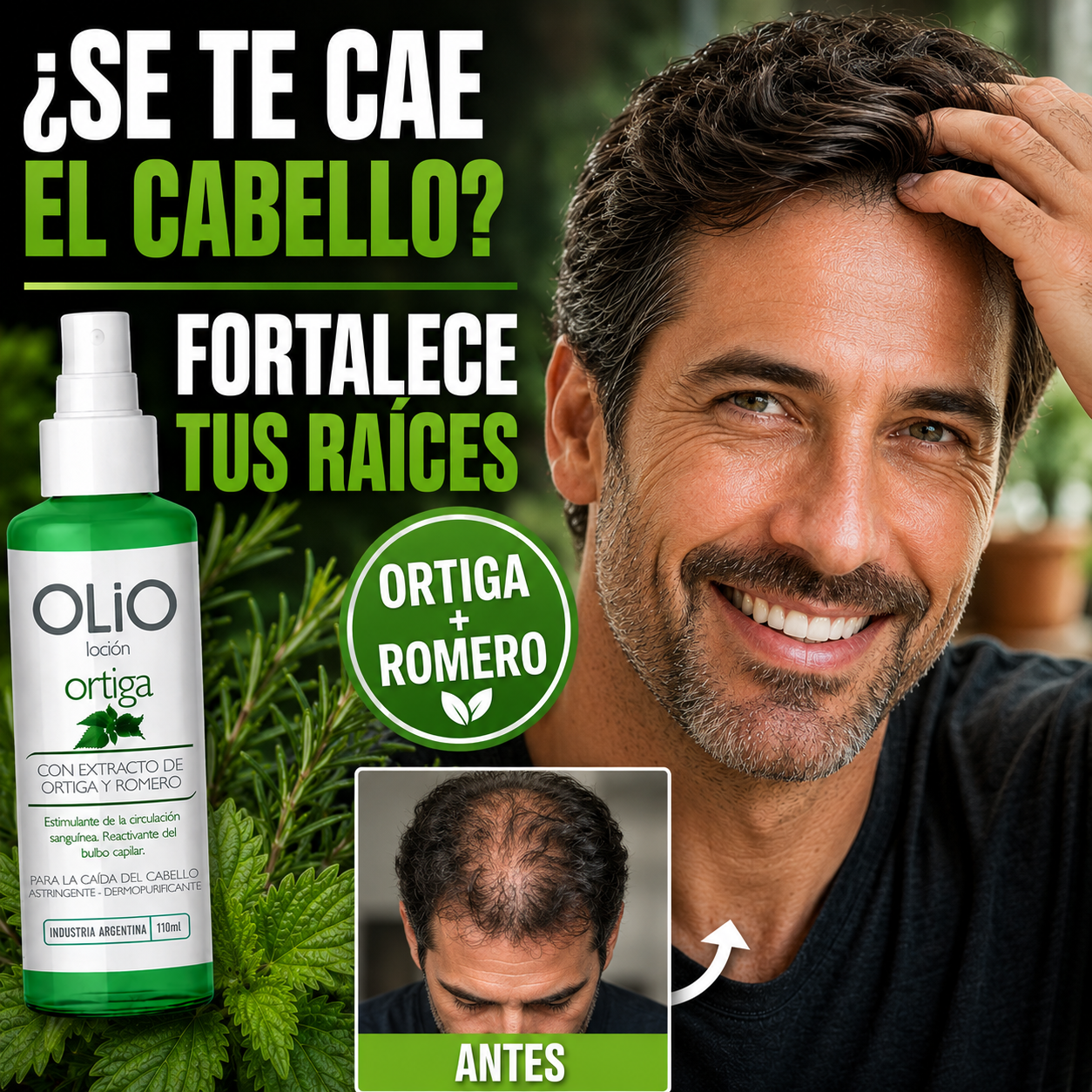 Loción Anticaída OLIO – Fórmula con Ortiga y Romero Oferta limitada 2x1!