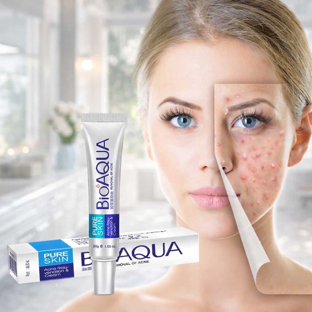 Bioaqua Anti Acne Cream – Control de Grasa • Reducción de Poros • Reparación de Marcas
