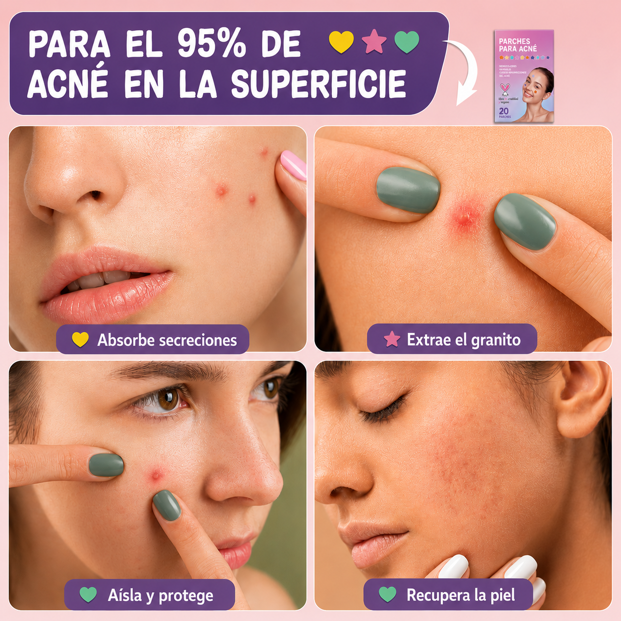 Parche Para Acné – Parches Invisibles Hidrocoloides Anti Imperfecciones