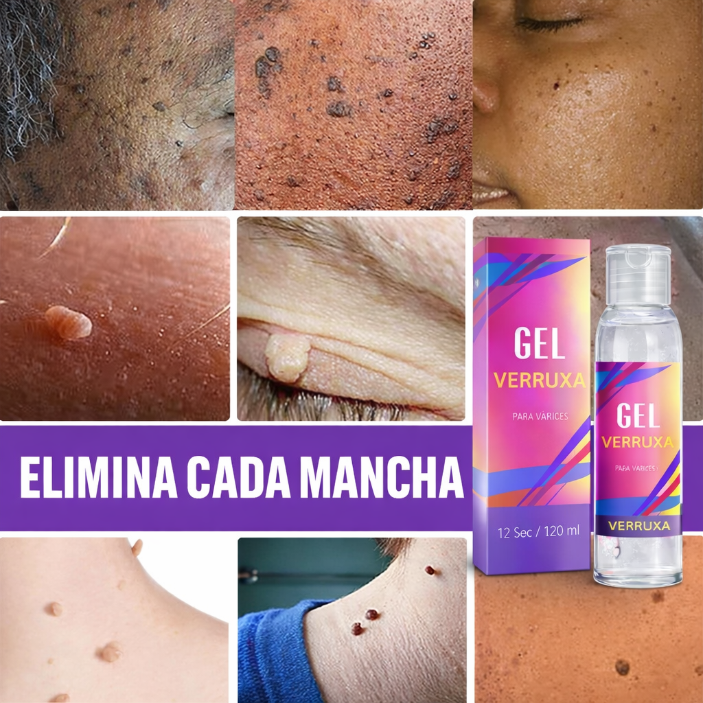 Gel para eliminar verrugas Verruxa: tratamiento avanzado para una piel limpia y sana.
