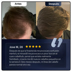 Sérum avanzado para el crecimiento del cabello de Bodywise: cabello más fuerte, denso y saludable