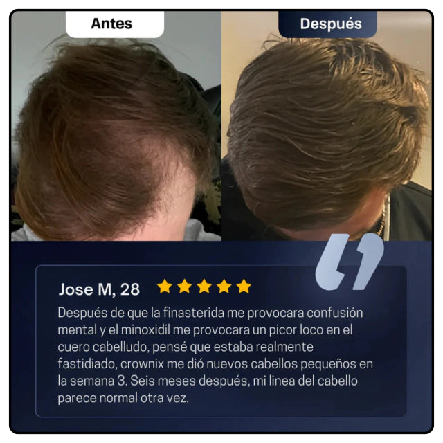 Sérum avanzado para el crecimiento del cabello de Bodywise: cabello más fuerte, denso y saludable