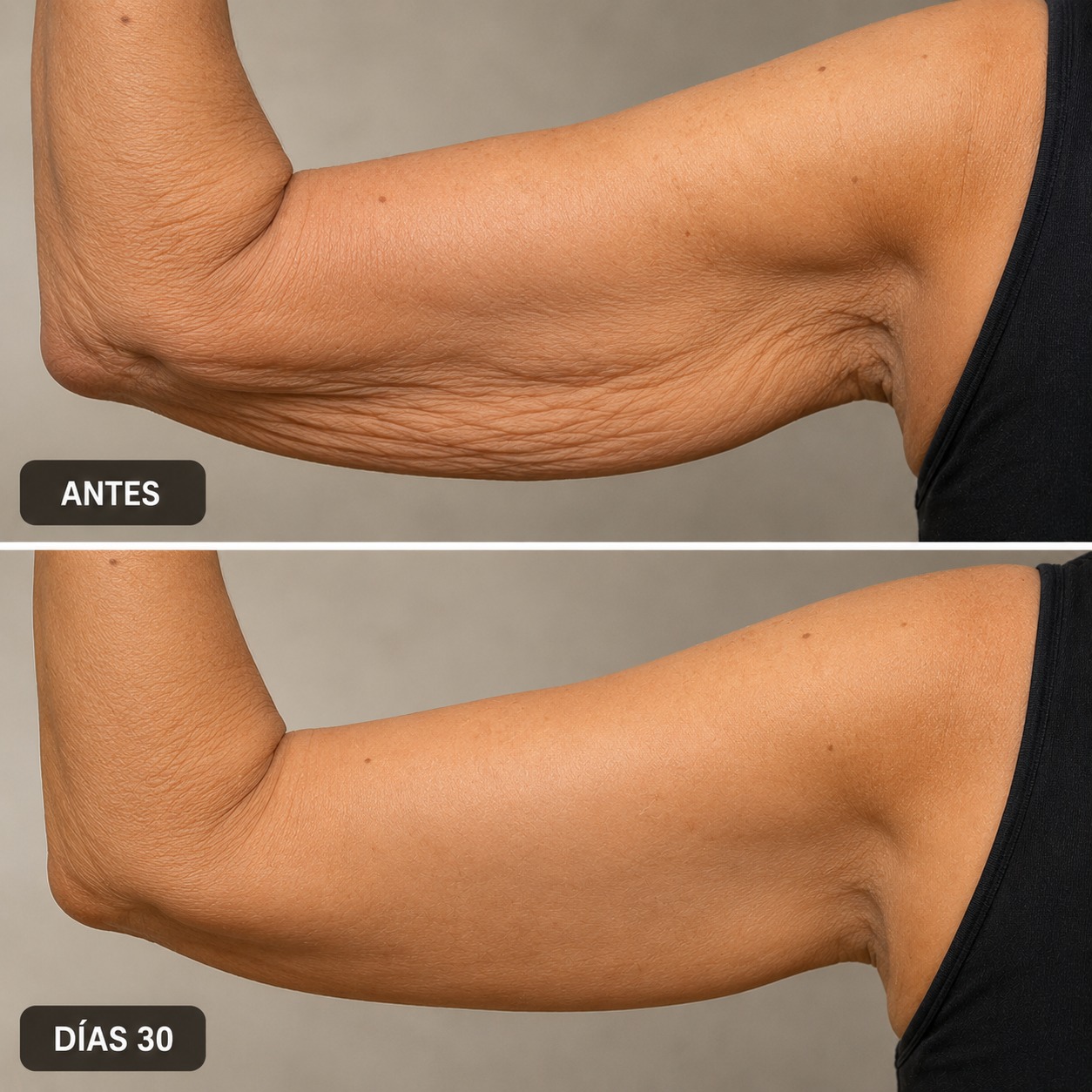 Aceite Anticelulítico Reafirmante - Piel Más Lisa y Firme (2x1 Oferta)