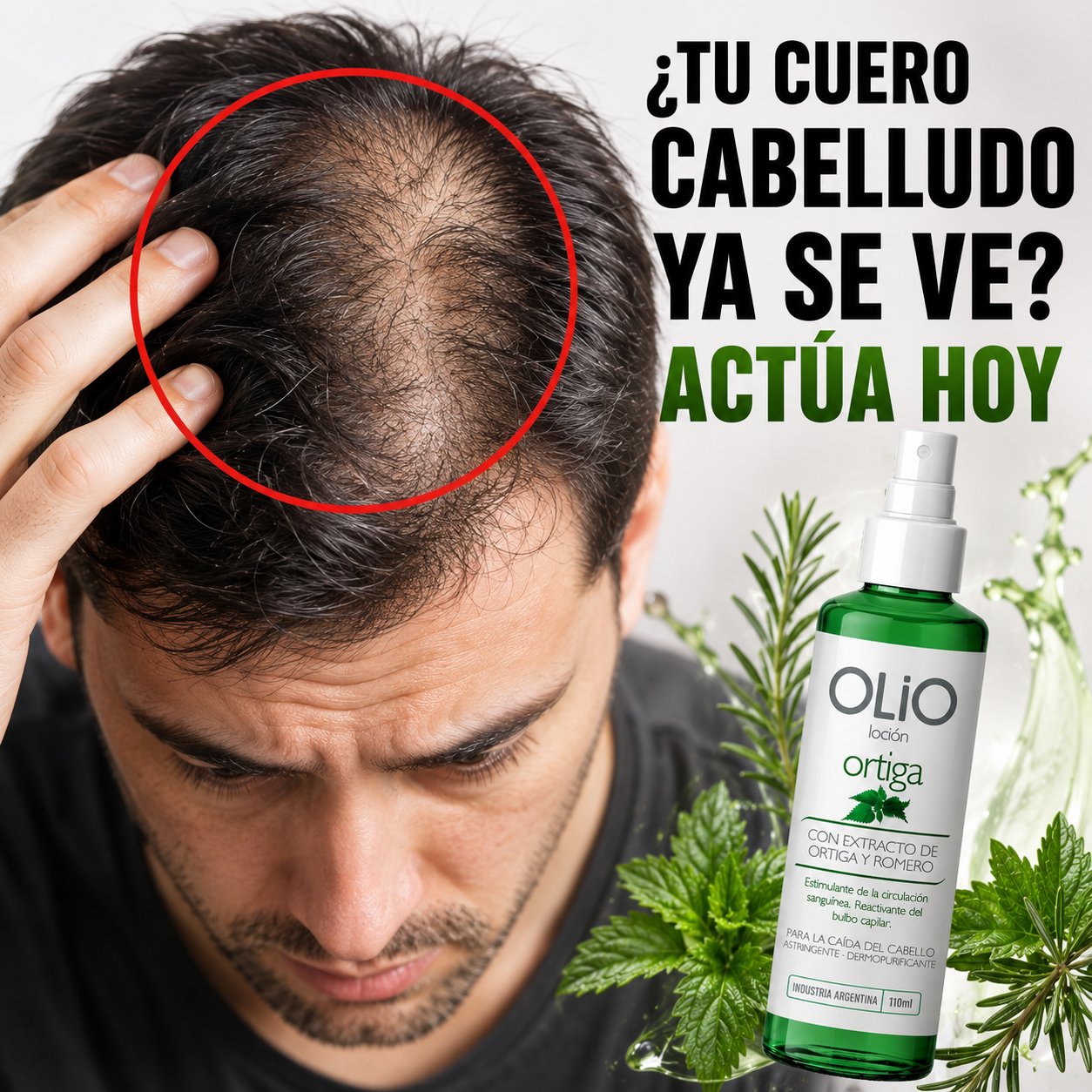 Loción Anticaída OLIO – Fórmula con Ortiga y Romero Oferta limitada 2x1!