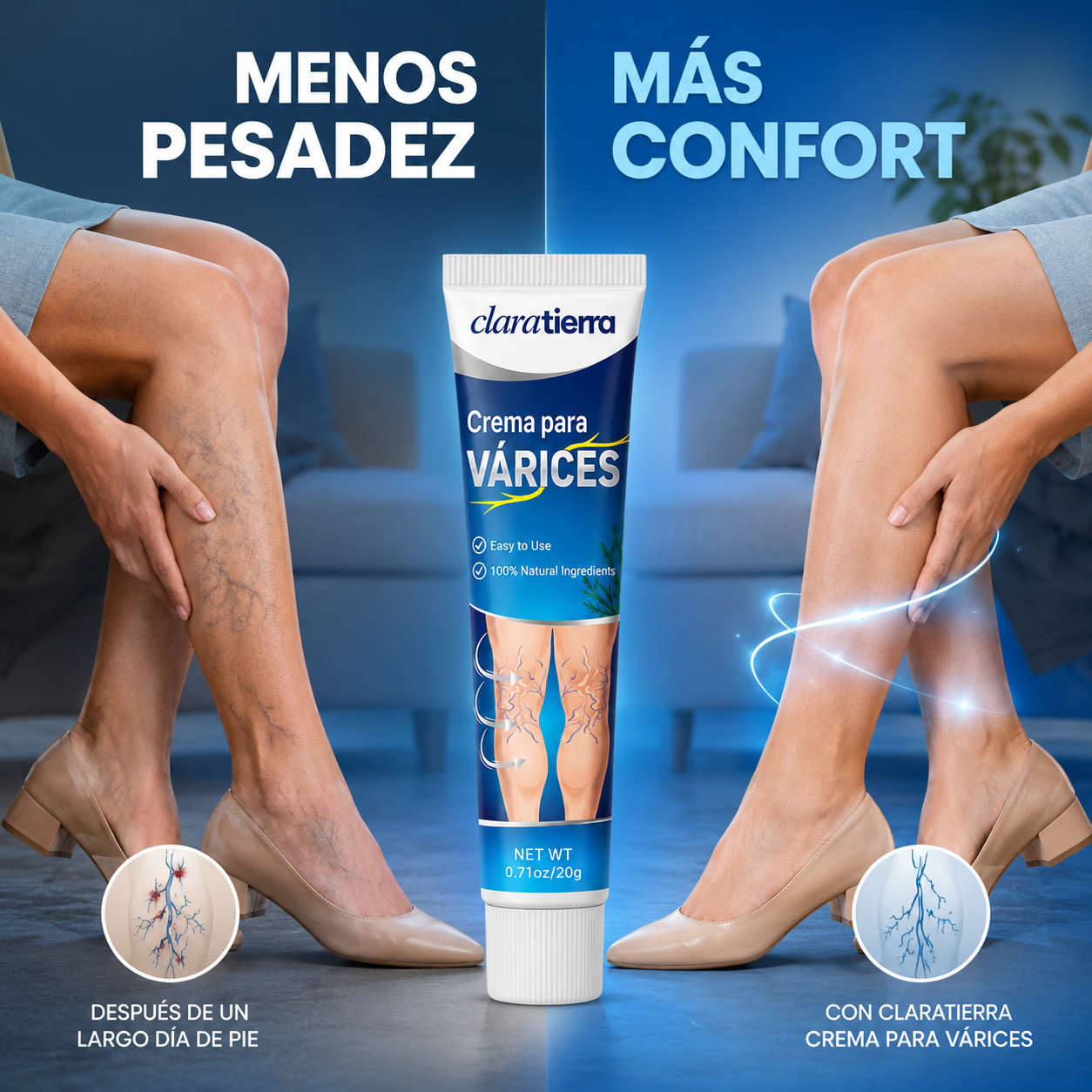 Crema para Várices – Fórmula Calmante para el Cuidado de las Piernas