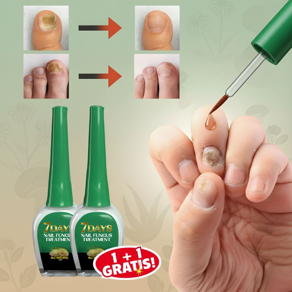 Tratamiento de 7 días para hongos en las uñas: Rápido, natural y eficaz "OFERTA 2x1"