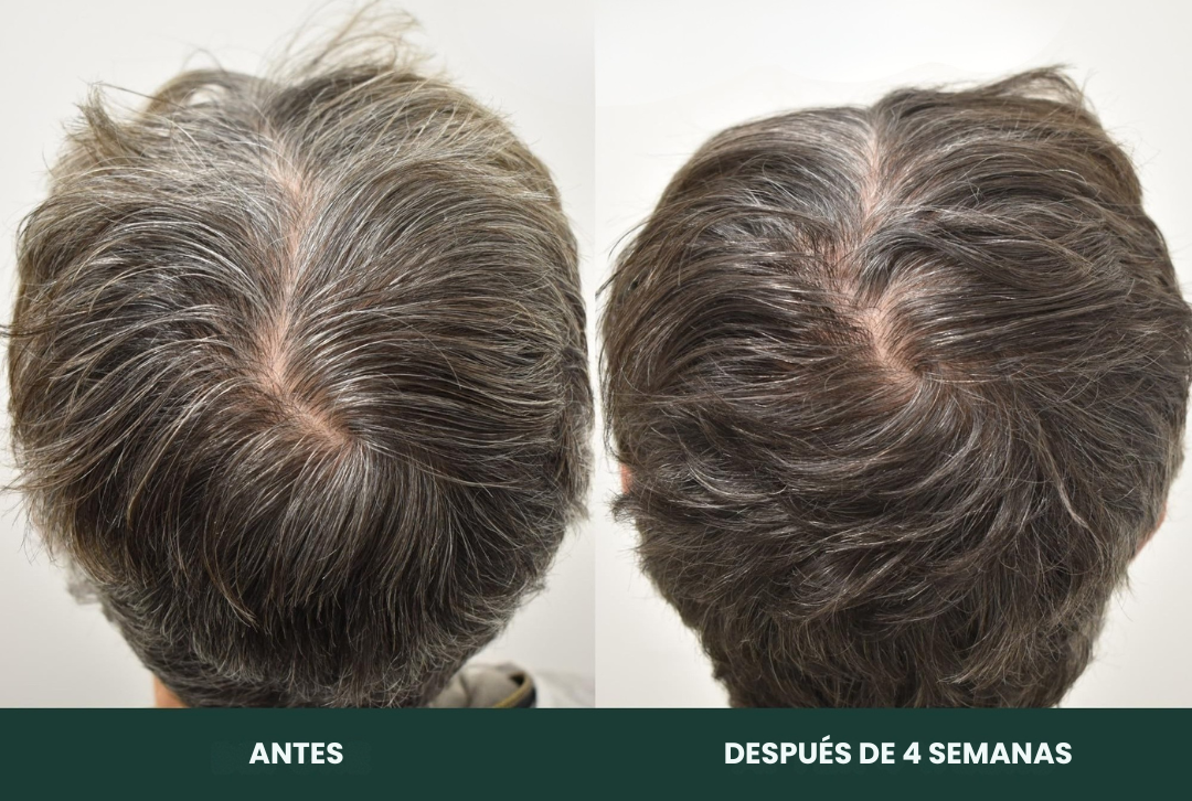 Shampoo que Cubre las Canas al Instante – 100% Natural y Seguro