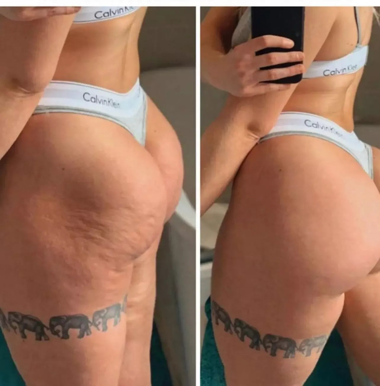 Suplemento Anticelulitis Natural