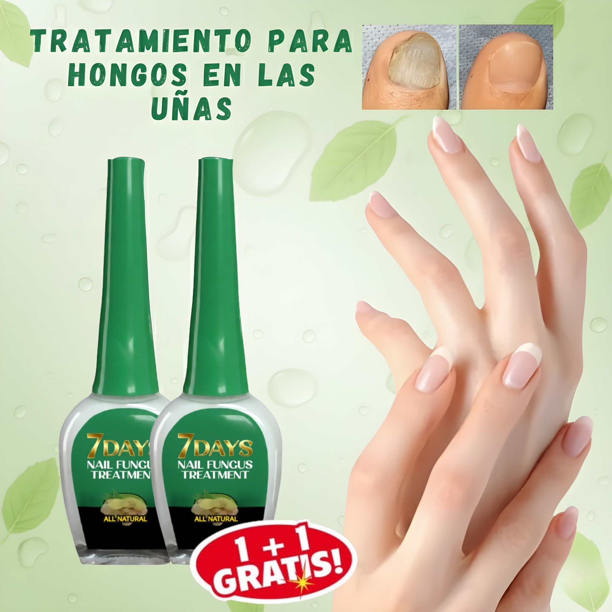 Tratamiento de 7 días para hongos en las uñas: Rápido, natural y eficaz "OFERTA 2x1"