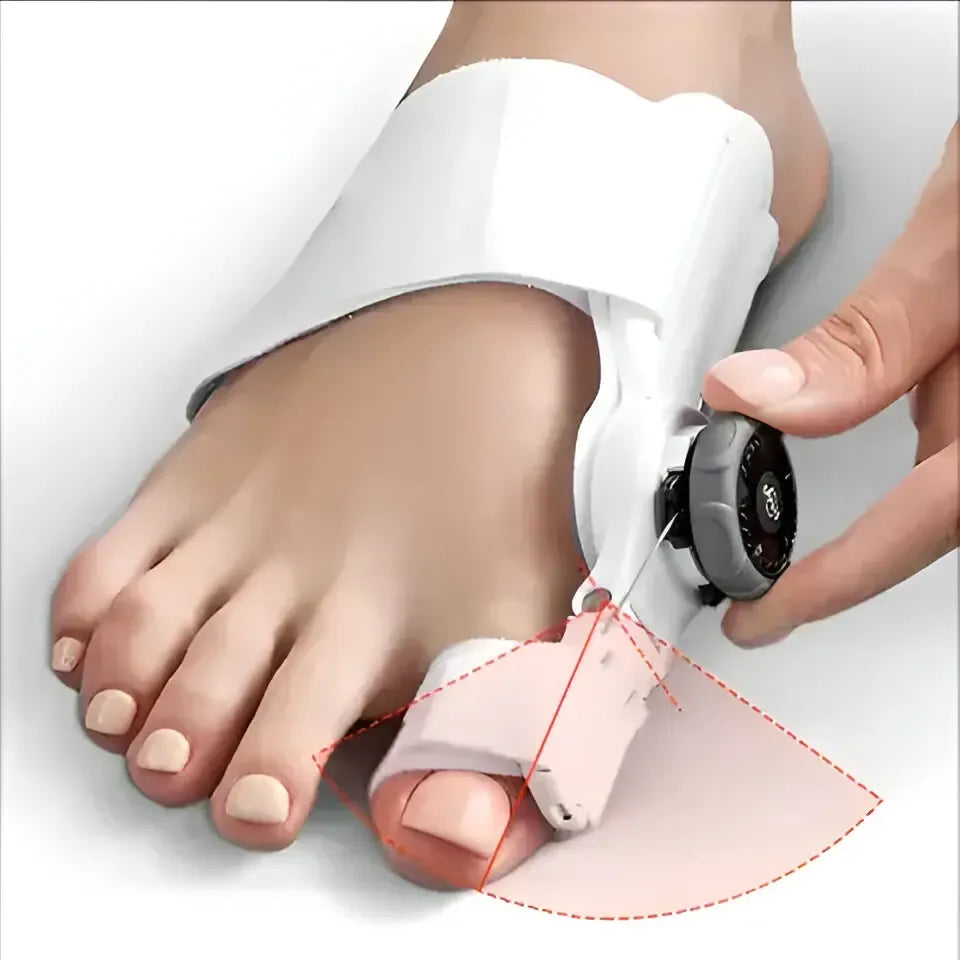 Corrector Plus™ – Alineador Ortopédico para Juanetes | Alivia el Dolor y Corrige sin Cirugía