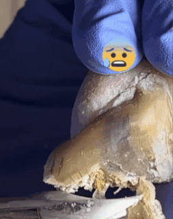 Uñas Libres de Hongos en 7 Días – Tratamiento Natural y Efectivo