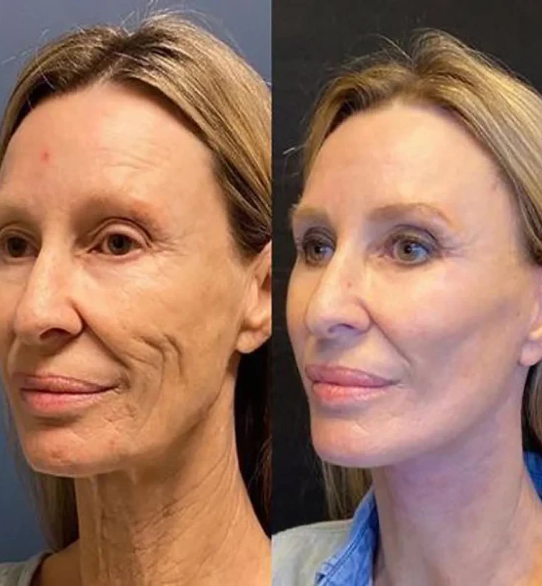 Regenessa™ – Ritual Antiedad Día/Noche