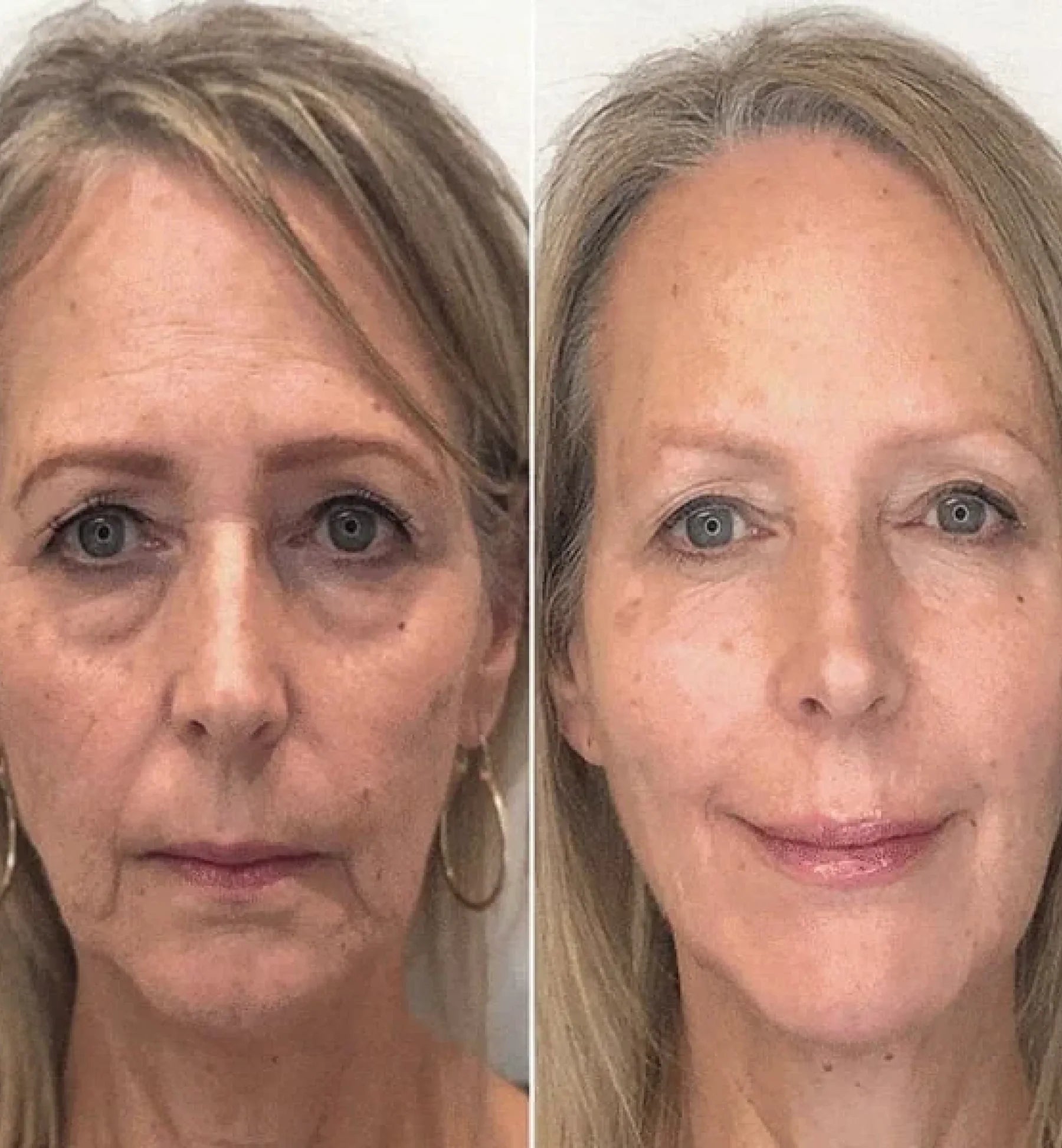 Regenessa™ – Ritual Antiedad Día/Noche