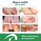 Spray para pie de atleta