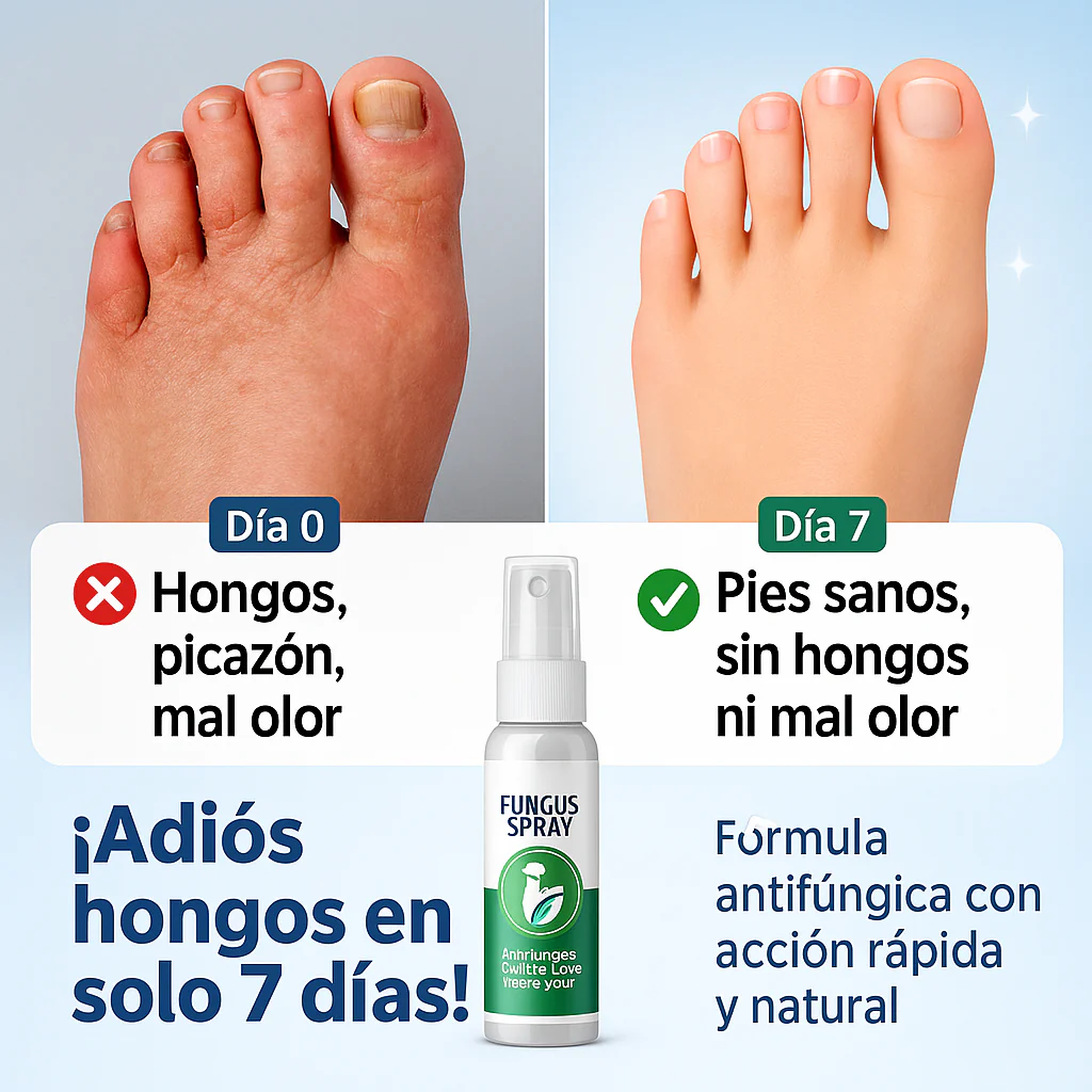 Spray para pie de atleta