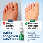 Spray para pie de atleta