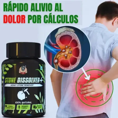 Stone Dissolver+ – Suplemento Natural para Eliminar Cálculos Renales y Proteger la Salud Urinaria