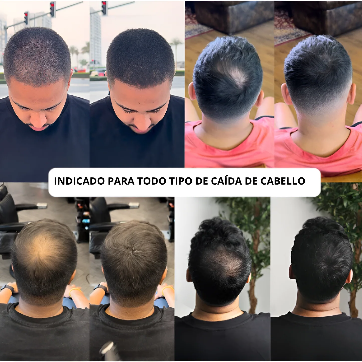 Zenora Anti-Complejos