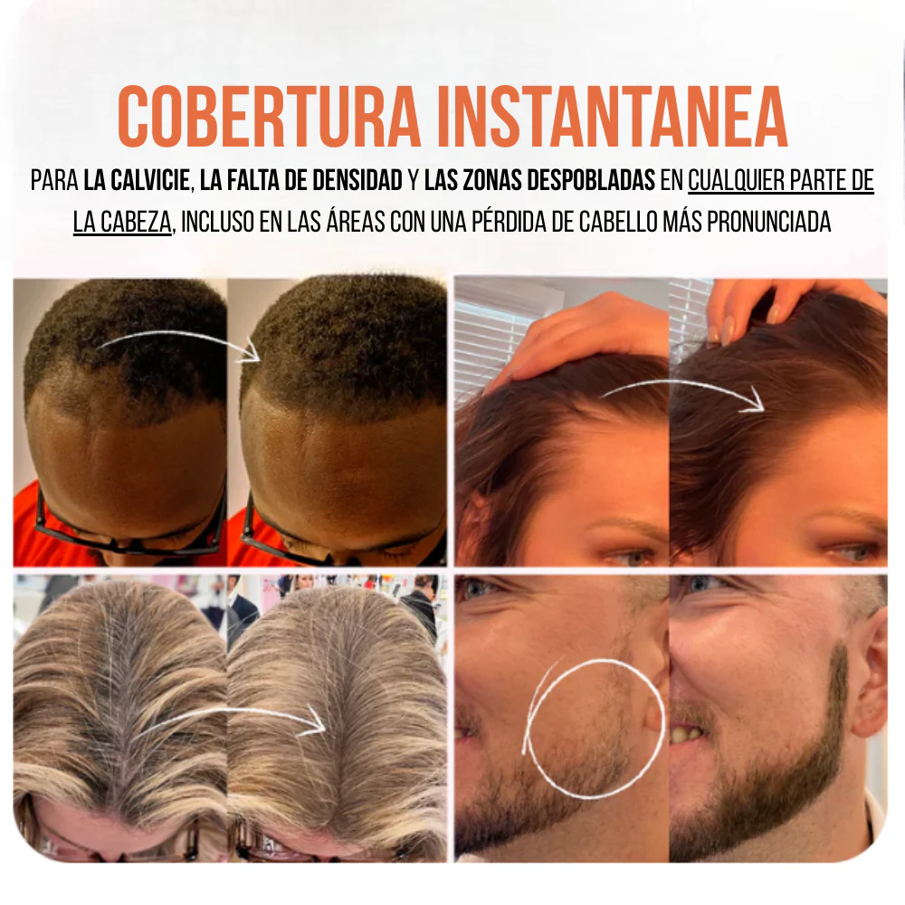 Zenora Anti-Complejos